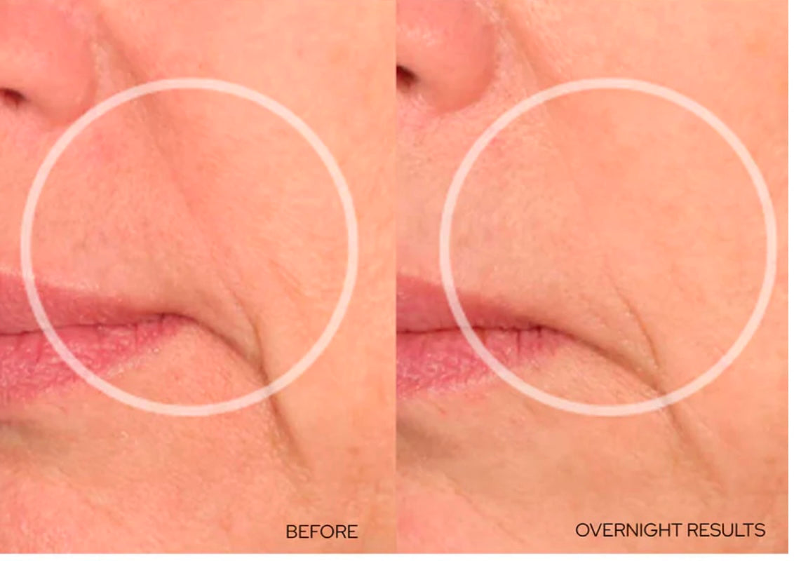 SiO Super LipLift Reusable Patches