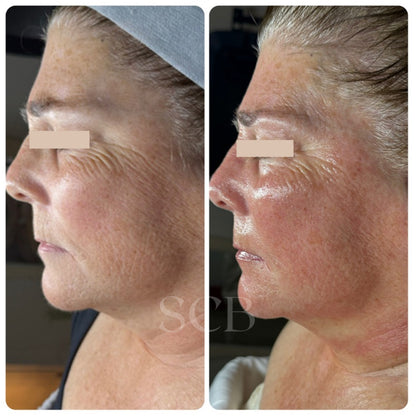 Side-by-side comparison of a woman&